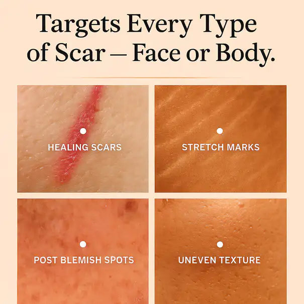 Silicone Scar Stick