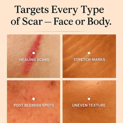 Silicone Scar Stick